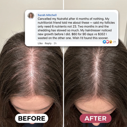 Ah-Mazing Hair
Vitamin Gummies